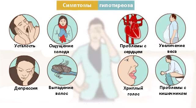 gipotireoz-simptomi