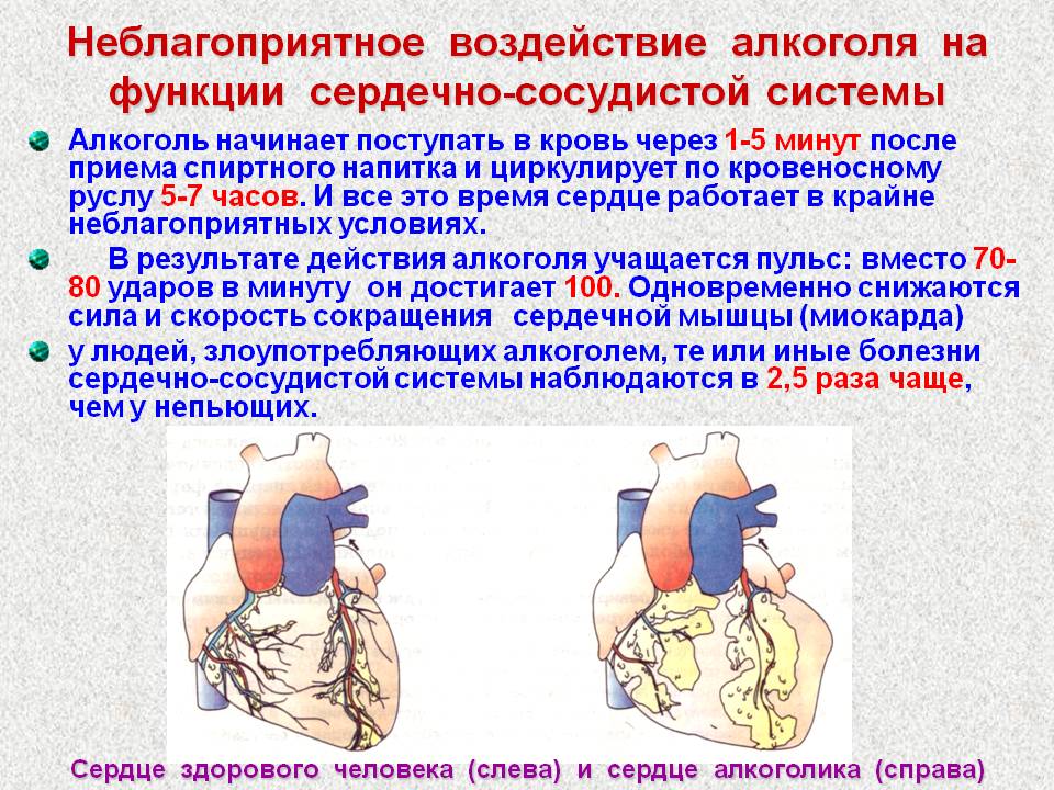 Воздействие алкоголя на сердце