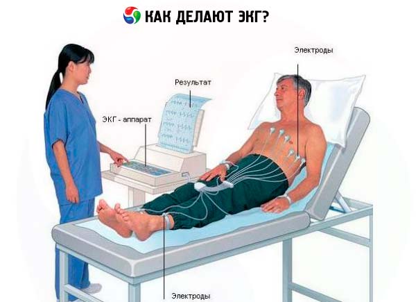 Методика проведения электрокардиографии