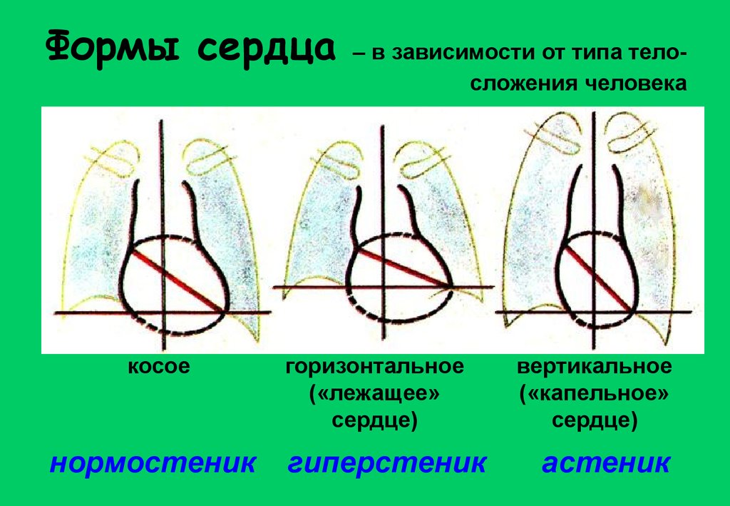 Формы сердца