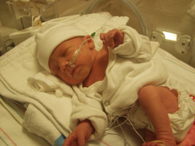 Новорождённый после операции 