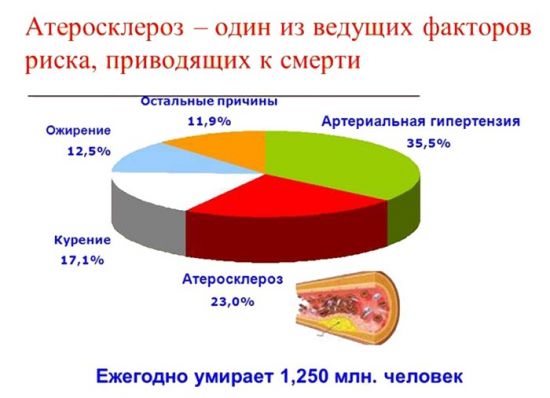 Смертность от атеросклероза