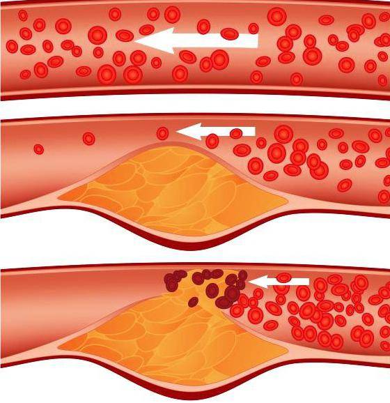 Таблетки Arterium рибоксин - отзывы