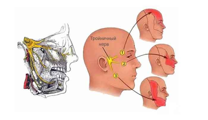 Причины и лечение частых головных болей