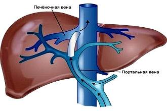 Внутрипеченочная гипертензия