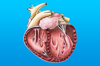 Симптомы кардиопатии