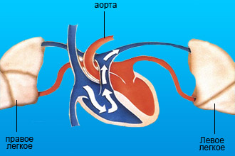 Лечение при сердечно-легочной недостаточности
