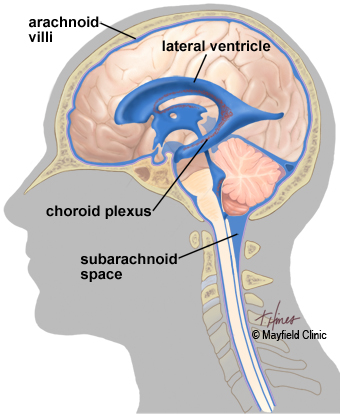 normal ventricles