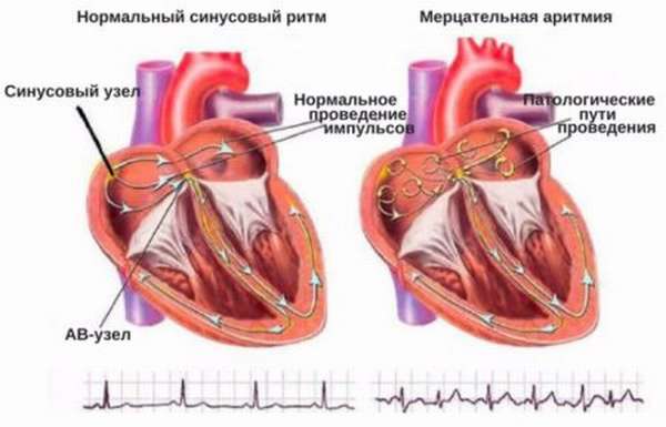 Как проводят расшифровку результатов УЗИ сердца, нормы и отклонения