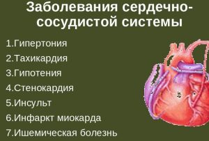 сердечно сосудистая система, артерии и вены, картинка