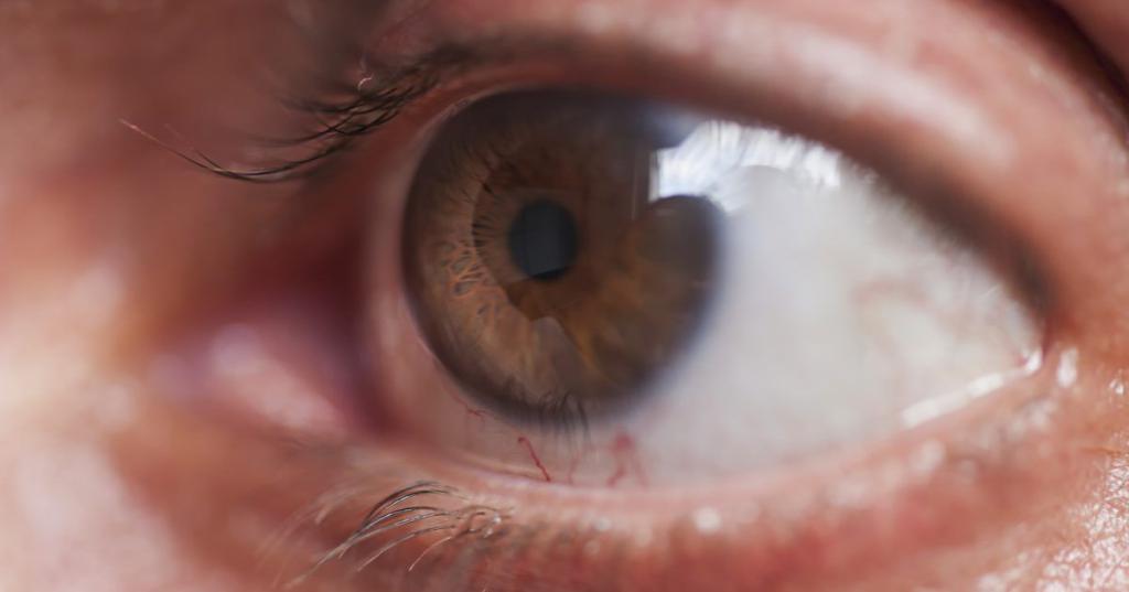 как проверить глазное давление в домашних условиях