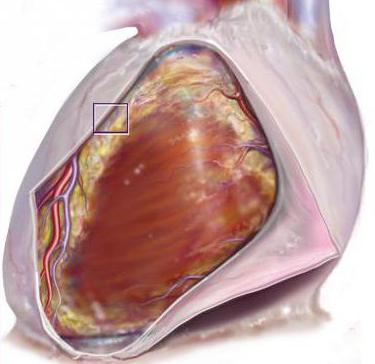 мышечная оболочка сердца