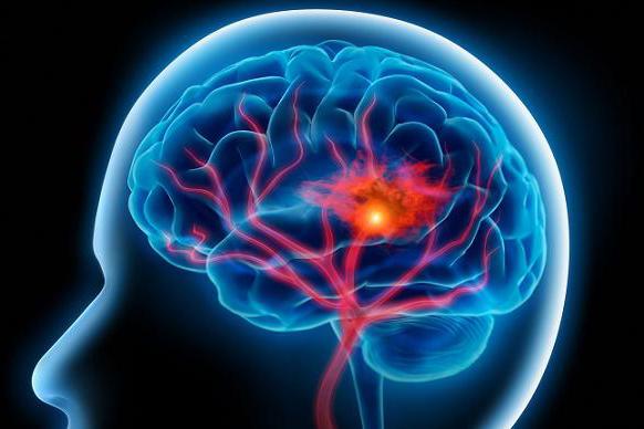 укрепление сосудов головного мозга народные средства