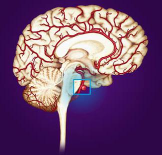 аневризма головного мозга симптомы