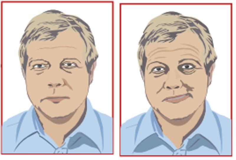 Проявление приступа
