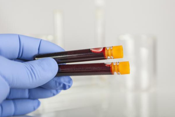 меняется ли группа крови у человека 