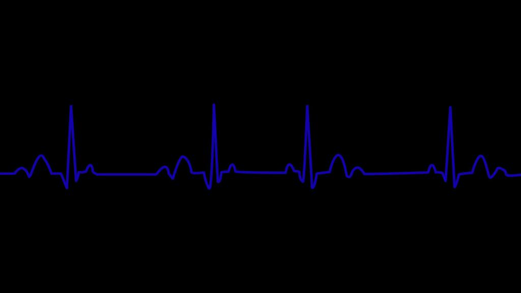 Кардиограмма здорового человека