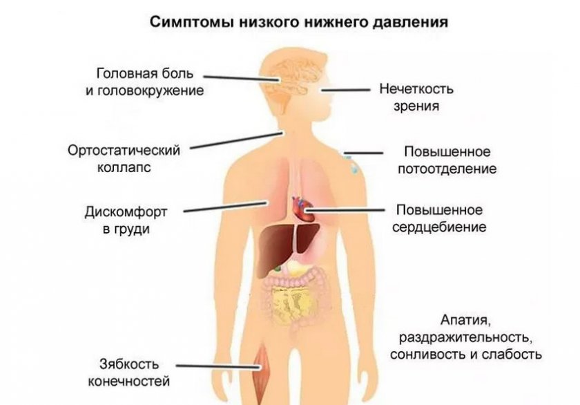 Симптомы гипотонии