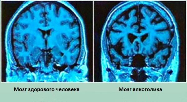 сравнение мозга