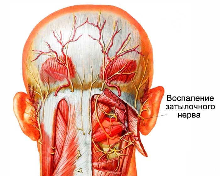 Боли в голове – причины и лечение, к какому врачу обратиться