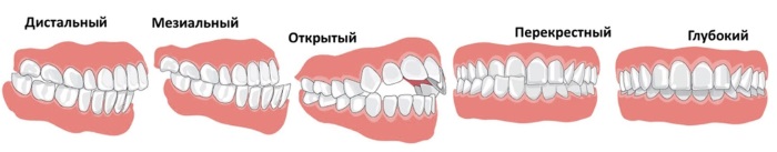 Боли в голове – причины и лечение, к какому врачу обратиться