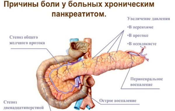 Диета при панкреатите поджелудочной железы. Меню на неделю, рецепты, продукты, что нельзя