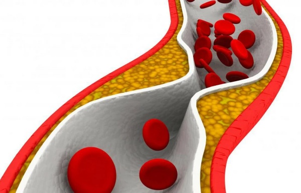 Препараты для чистки сосудов от холестерина и бляшек, травы, народные средства