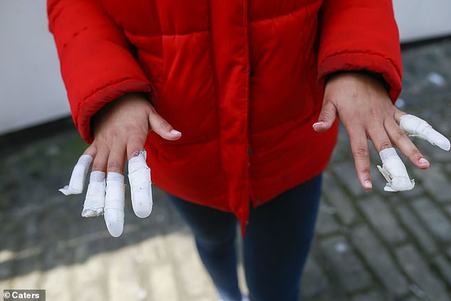 A 13-year-old girl faces surgery to repair damage to her hands, pictured, after her acrylic fingernails were ripped off in a 