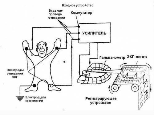 Схематическое изображение цепочки снятия электрокардиограммы