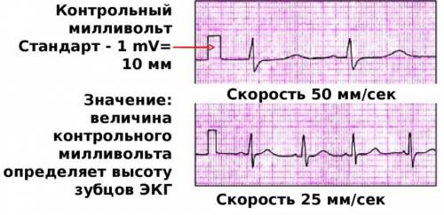 Контрольный миливольт