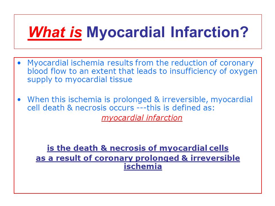 What is Myocardial Infarction.