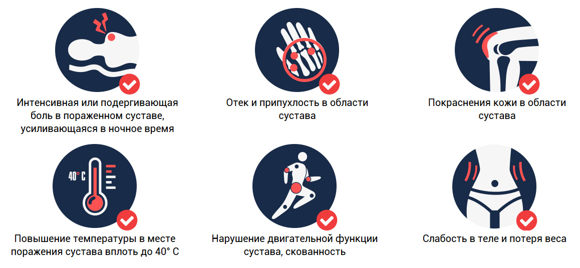 Симптомы артрита