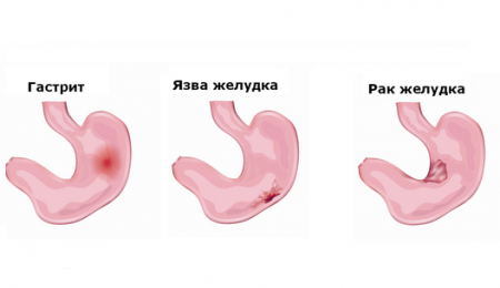 Другие причины
