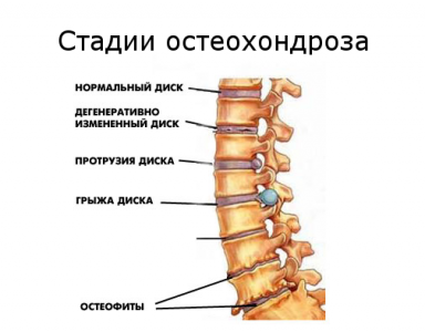 Патологии и травмы позвоночника
