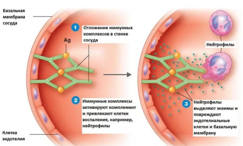 неестественная реакция иммунной системы