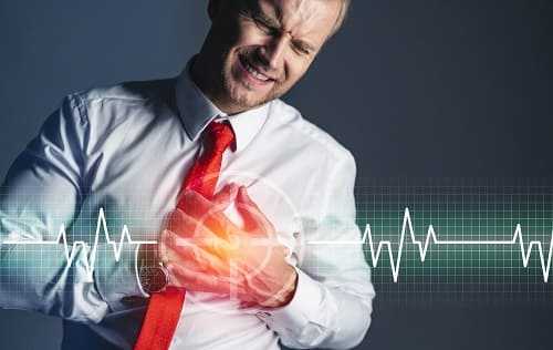 Сердечный приступ и аритмия у мужчины