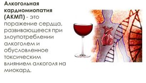Как лечат алкогольную кардиомиопатию