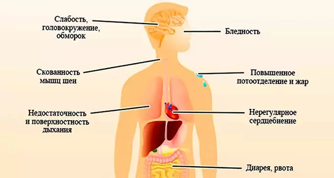 Симптомы снижения давления