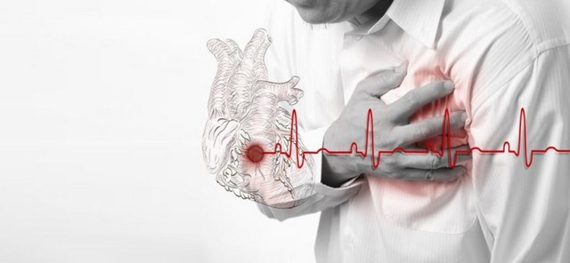 Классификация инфаркта миокарда: все виды и их особенности