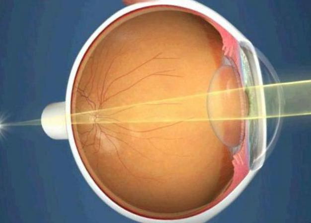 ангиопатия сетчатки обоих глаз гипертоническая причины