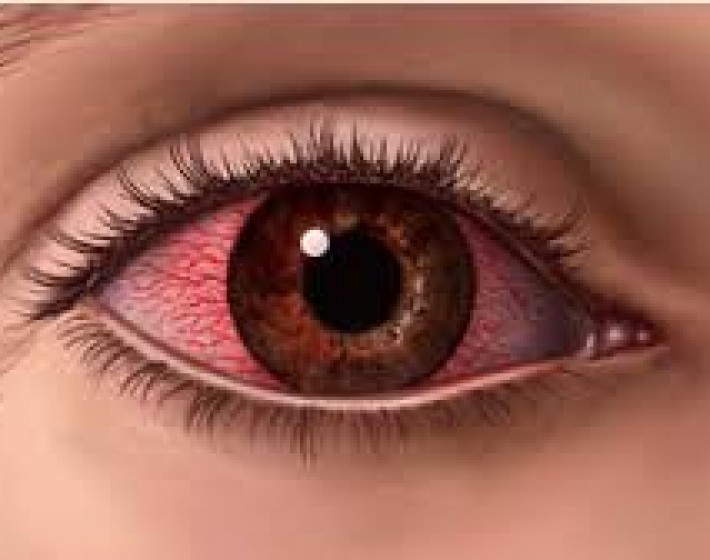 глазное давление норма 50 лет у женщин