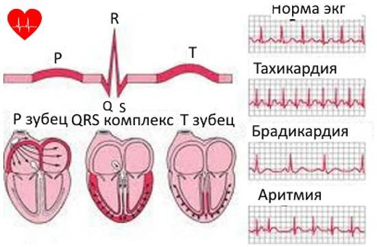 Измерение пульса на лучевой артерии