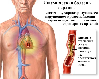 Общие представления о заболевании