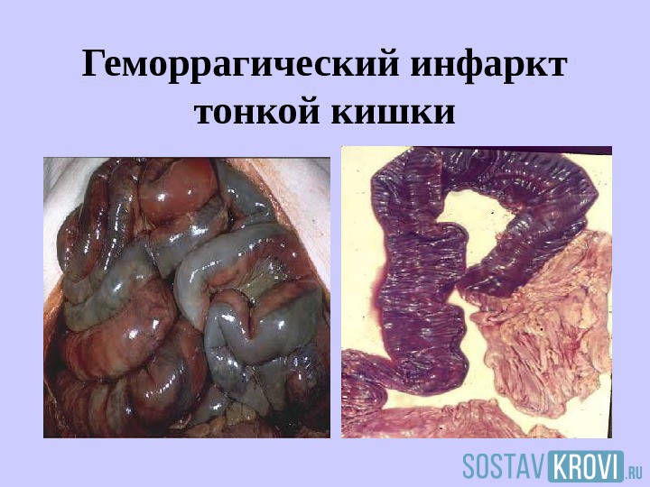 Стадии