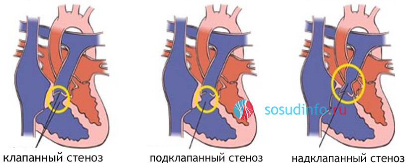 5468486486