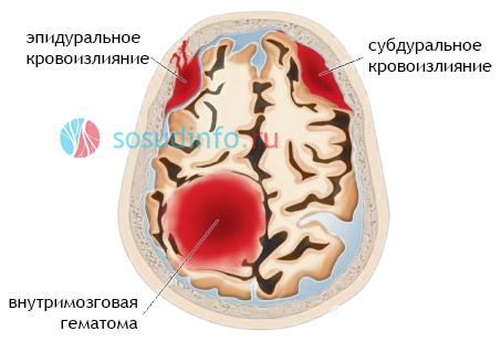 546545566
