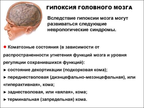 Гипоксия головного мозга