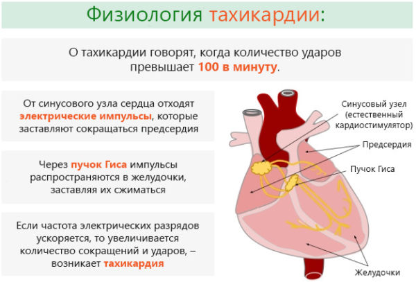 Физиология тахикардии