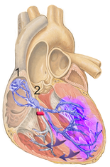 Normal electrical conduction system of the heart (Schematic). All myocardial segments are excited almost simultaneously (purple staining). Sinoatrial nodeAtrioventricular node