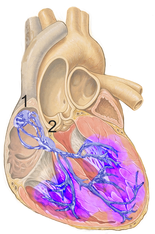 Normal electrical conduction system of the heart (Schematic). All myocardial segments are excited almost simultaneously (purple staining). Sinoatrial nodeAtrioventricular node